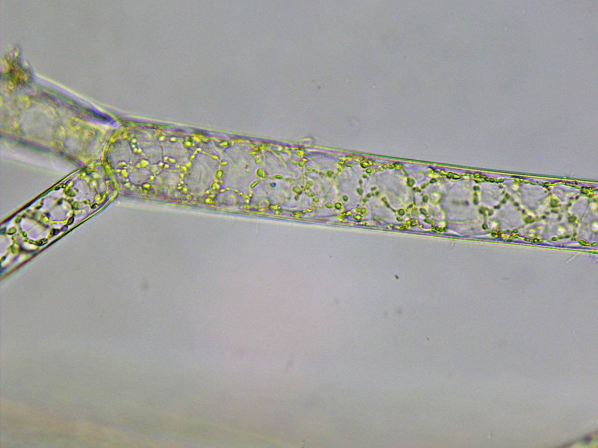 <p>Dernière photo, montrant la disposition des chloroplastes et la cloison entre rameaux, bien oblique.</p>