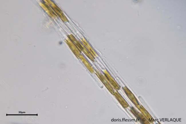 <p>Et la 3e... C'est très petit.</p>