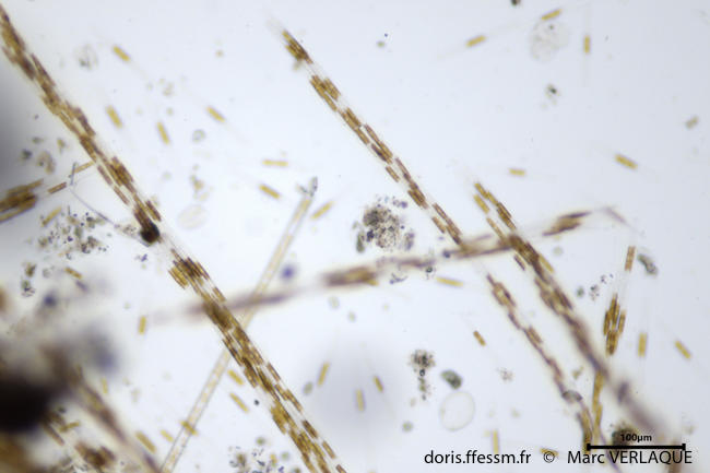 <p>Grossissement plus fort</p>