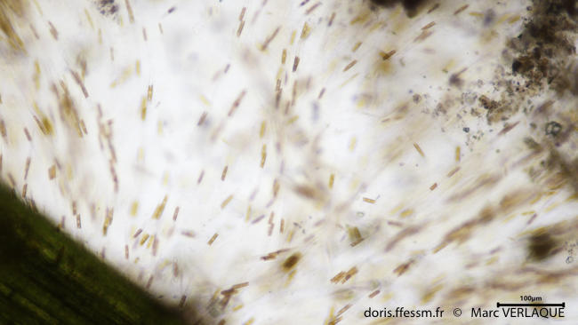 <p>Voici les photos au microscope.</p>