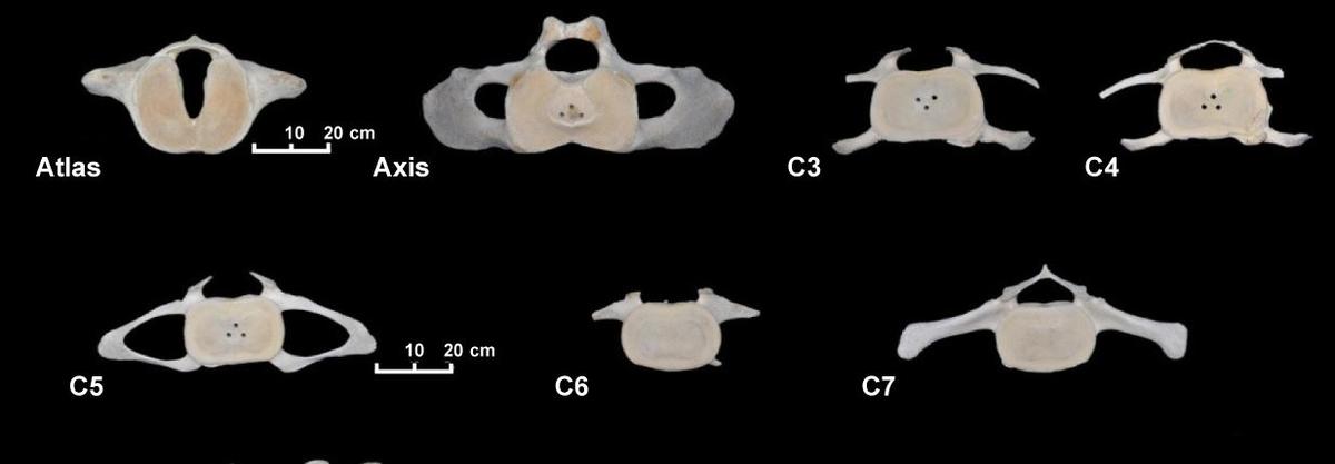 <p><a href="http://amz.museucienciesjournals.cat/volume-12-2014-amz/descripcion-osteologica-del-rorcual-comun-balaenoptera-physalus-linnaeus-1758-d...