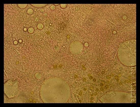 Bonjour, voici une photo sous microscope de l'extrêmité de la tentacule violette.<br />si les cellules rondes en bas à droite sont les zooxanthelle...