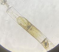 Identification microscopique 