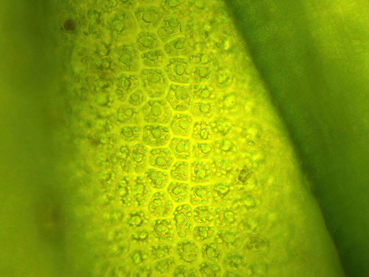<p>Vu des cellules à la surface d'un filament. On peut voir les pyrénoïdes, plutôt nombreux dans chaque cellule.</p>