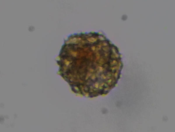 Micro-organisme dans ma mare (1)