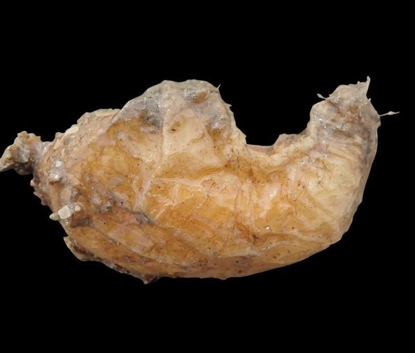 Microcosmus vulgaris?