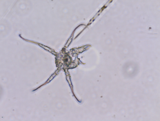 Microscopie - Aucune idée