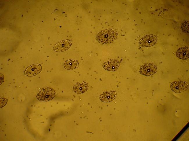 Et voilà les "petites sphères" (au microscope*, comme la photo précédente)<br />Tu penses toujours à des oeufs ?<br /><br />* avec un plus gros zoo...