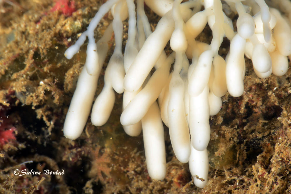 <p>une autre image. tu crois que ça peut être un parasite? En chapelet comme ça?  </p>