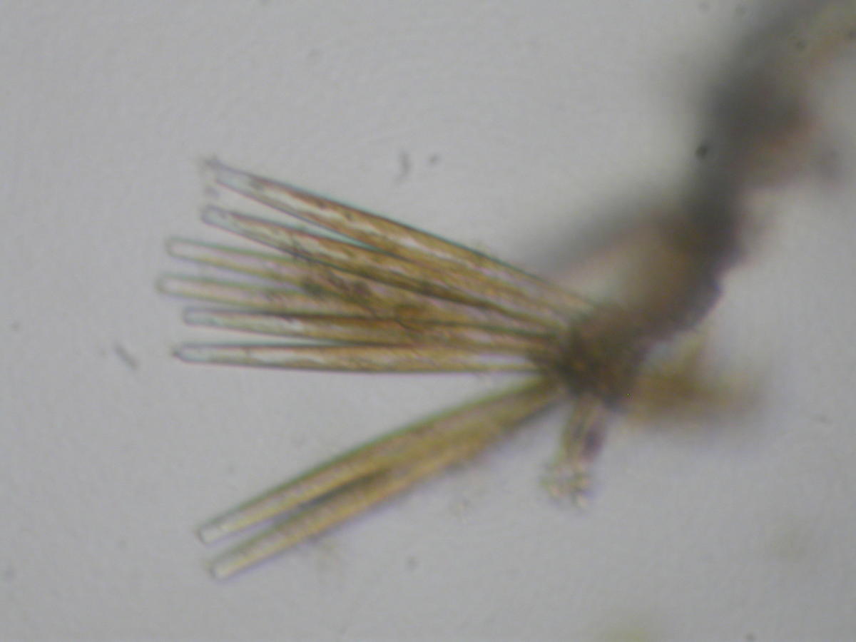 <p>Bonsoir,</p><p>sur la photo multiple, en haut à droite, est-ce que ce ne seraient pas simplement des diatomées fixées en épiphytes sur cette alg...