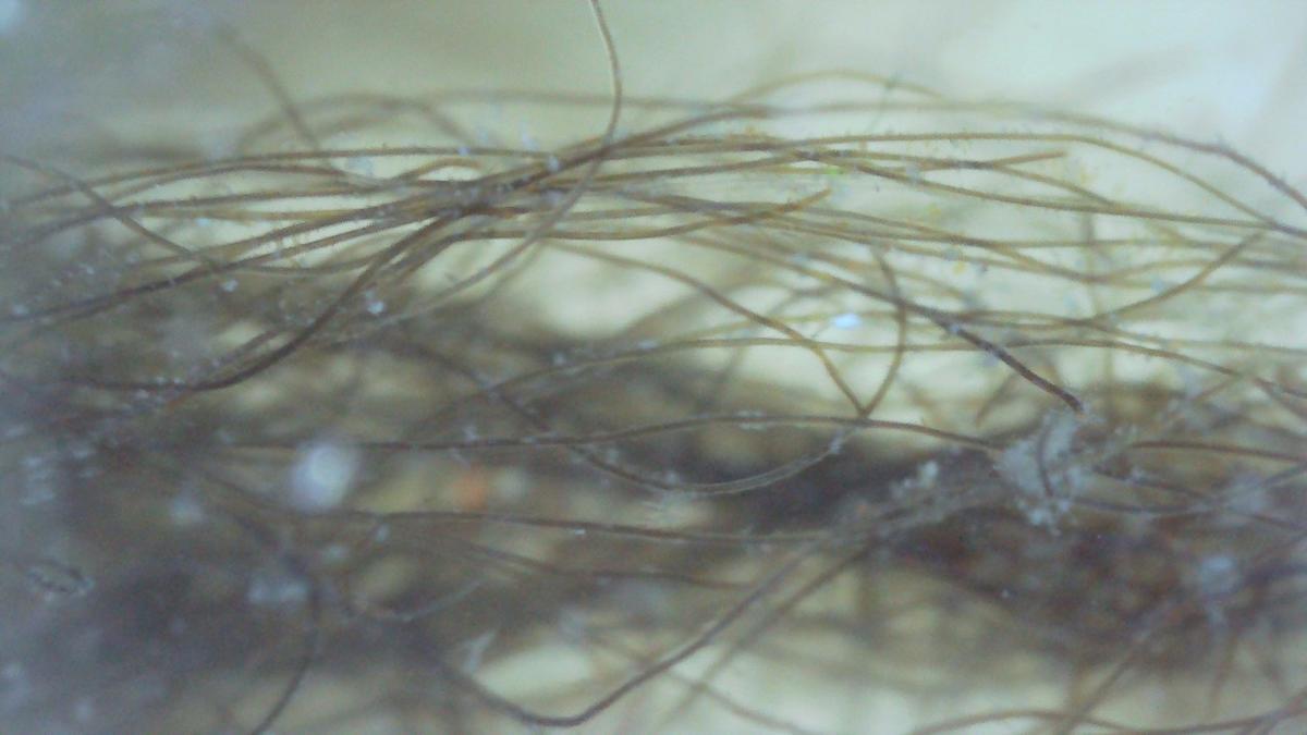 <p>Bonjour,</p><p>J'ai été à la marée hier et j'ai ramené une algue pour la regarder avec mon microscope rudimentaire, mais le résultat n'est pas t...