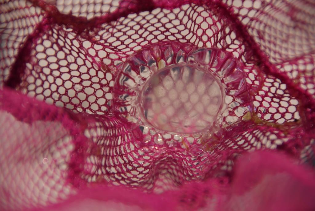 quelle est cette méduse ramassée dans un filet ?