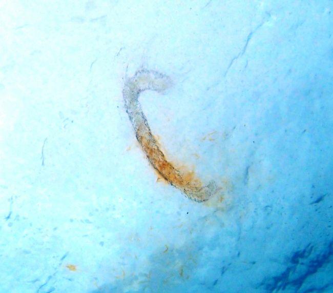 Salpe, Siphonophore ou autre?