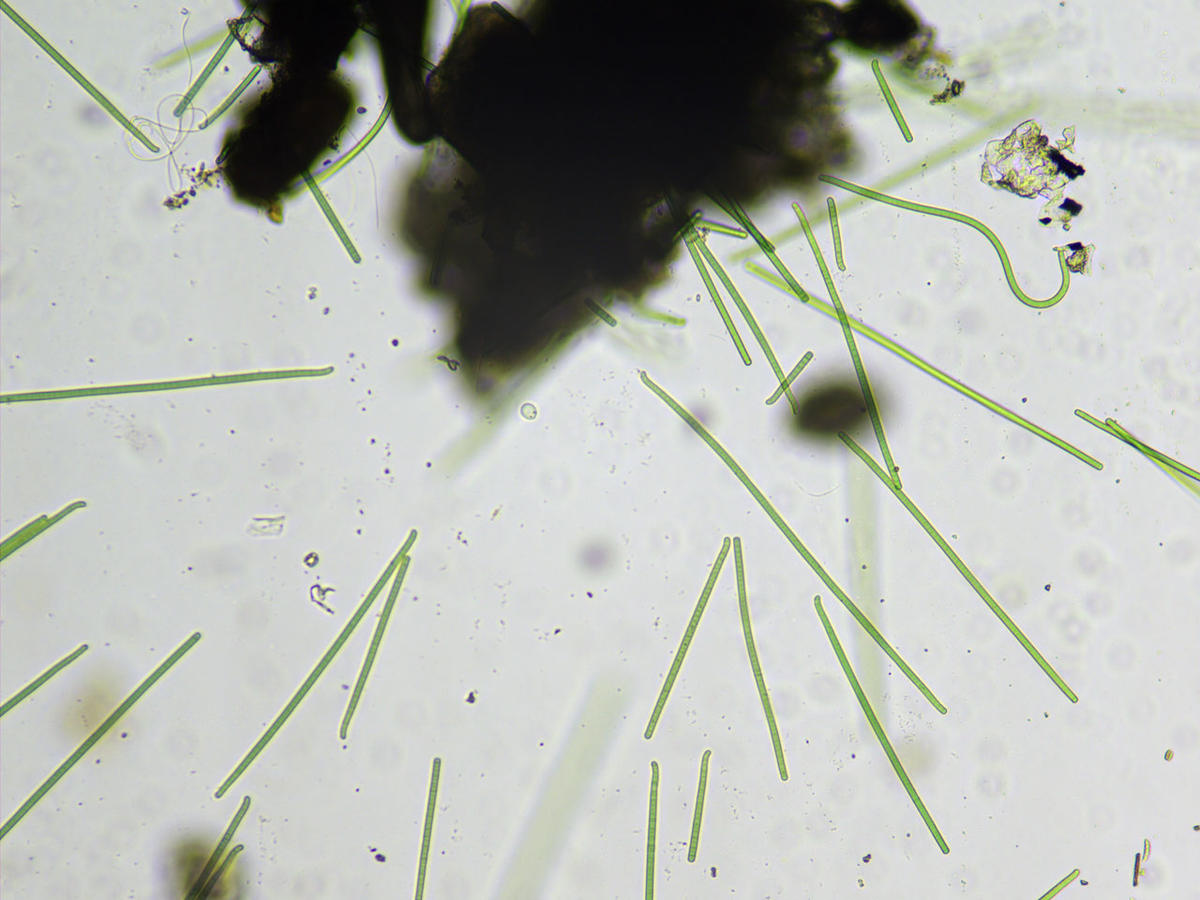 <p>Une première photo au microscope qui montre un groupe d'individus.</p>