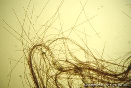 planktothrix_rubescens-gbo-19