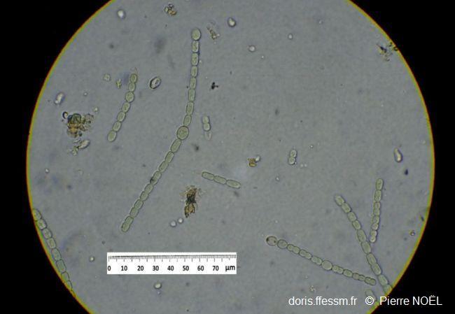 Azolla_filiculoides_pn_06