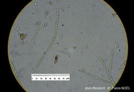 Azolla_filiculoides_pn_06