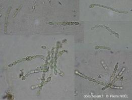 Azolla_filiculoides_Trichormus_azollae_pn_07
