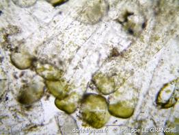 codium_adhaerens_utricules_x100-plg-img_60921
