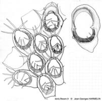Corbulella_maderensis-J.G-Harmelin-dessins