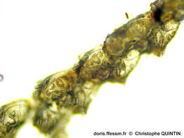 Cradoscrupocellaria_ellisii_qc_003