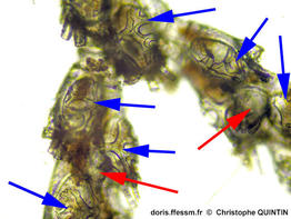 Cradoscrupocellaria_ellisii_qc_009