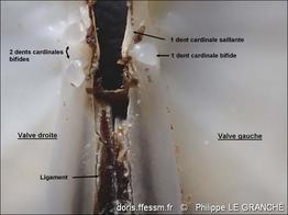 gari_depressa-plg-img_20002