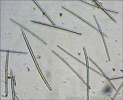 hymeniacidon_perlevis-plg-NA01
