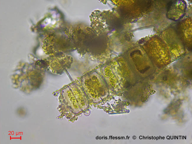 Melosira_moniliformis_cq_002