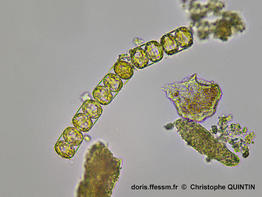 Melosira_nummuloides_cq_001