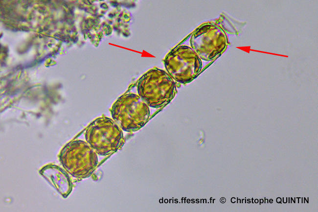 Melosira_nummuloides_cq_002