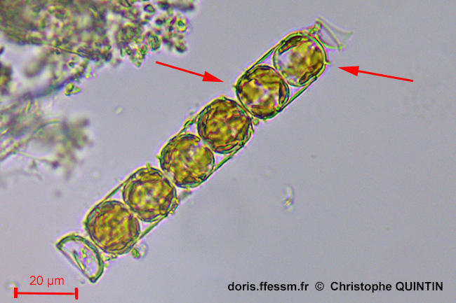 Melosira_nummuloides_cq_002