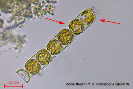 Melosira_nummuloides_cq_002