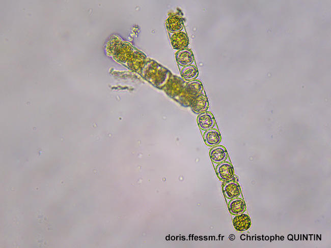 Melosira_nummuloides_cq_003.
