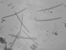 Oxe_Haliclona_indistincta