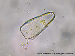 Petrodictyon_gemma_cq_002