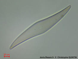 Pleurosigma_angulatum_cq_01