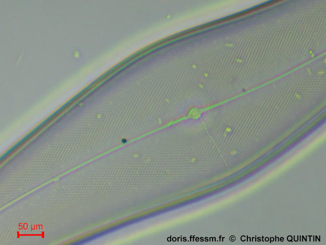 pleurosigma_angulatum_cq_02