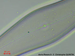 pleurosigma_angulatum_cq_02