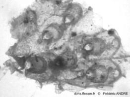 Schizomavella_halimedae-fran08