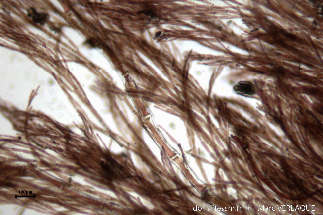 Seirospora_giraudii-mv1