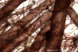 seirospora_giraudii-mv3