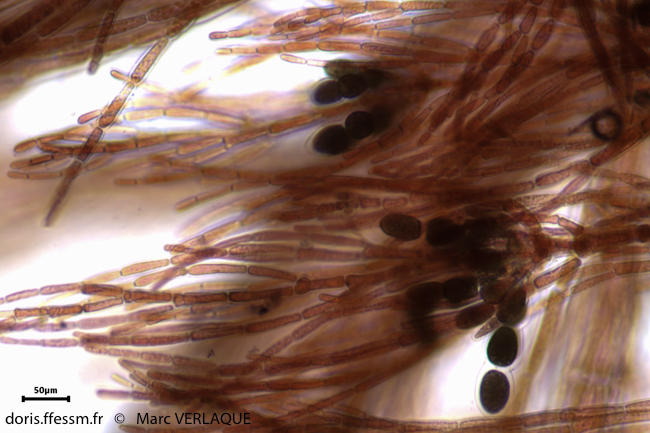 seirospora_giraudii-mv4