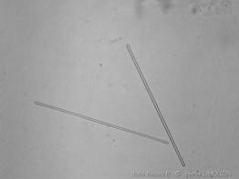 strongyle_glossaire-hLimouzin01