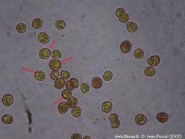 zooxanthelles_01_jpq_01